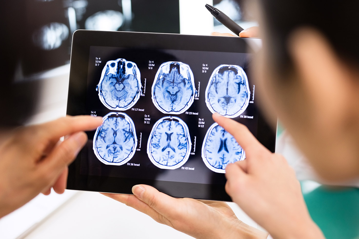 Two healthcare workers looking at brain scans on a tablet.